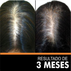 HAIR GROWTH - cauvirom 3m