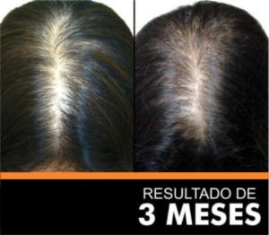 HAIR GROWTH - cauvirom 3m